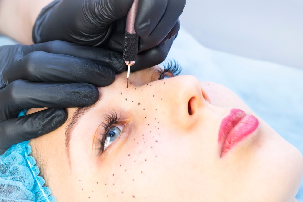 Tâches de rousseur – L'Atelier Beauté Coco'oning